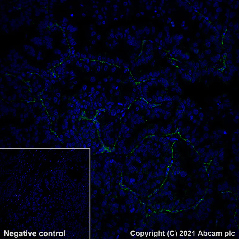 Immunohistochemistry (Formalin/PFA-fixed paraffin-embedded sections) - Alexa Fluor® 488 Anti-CD31 antibody [EPR3094] (AB275989)