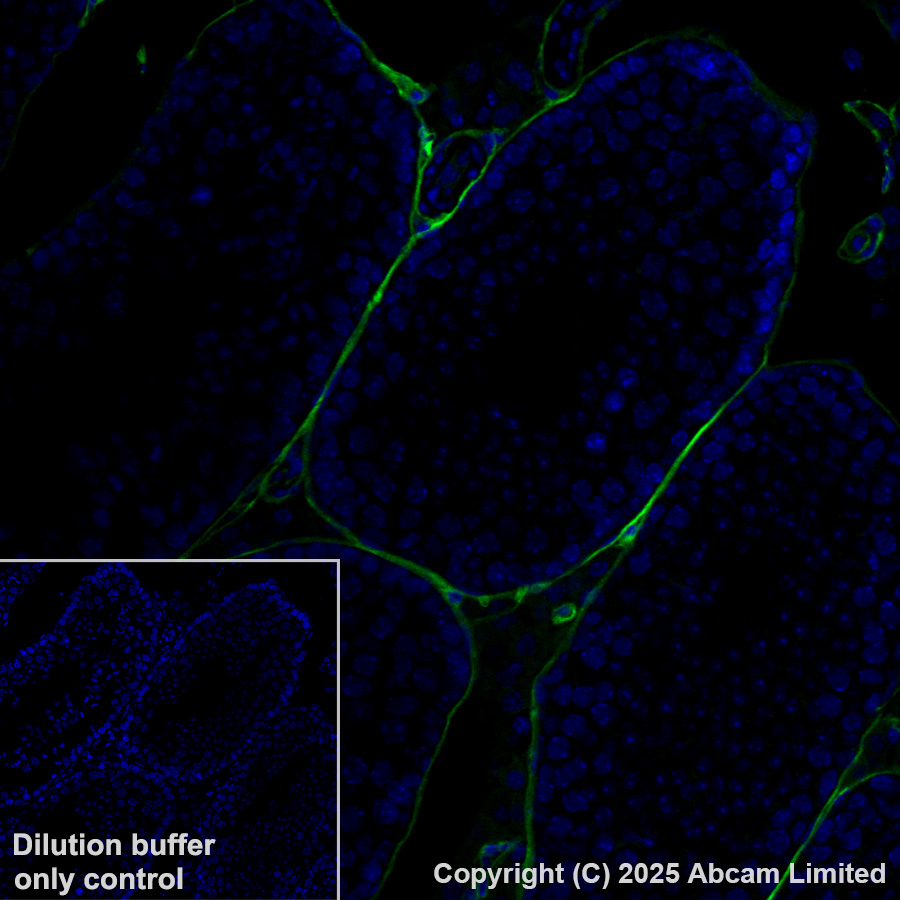 Immunohistochemistry (Formalin/PFA-fixed paraffin-embedded sections) - Alexa Fluor® 488 Anti-CD34 antibody [EPR27431-71] (AB323449), expandable thumbnail