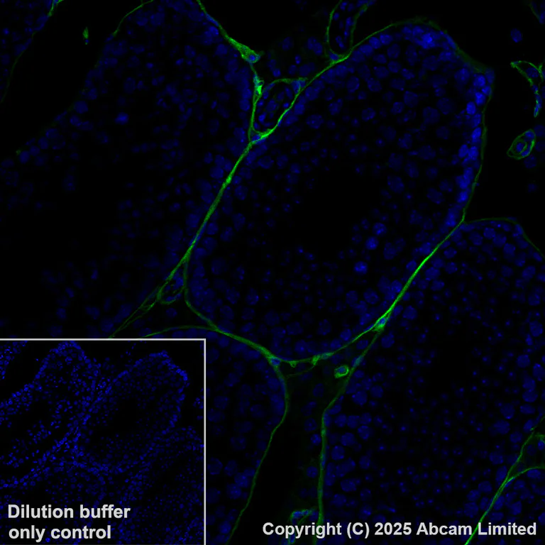 Immunohistochemistry (Formalin/PFA-fixed paraffin-embedded sections) - Alexa Fluor® 488 Anti-CD34 antibody [EPR27431-71] (AB323449)