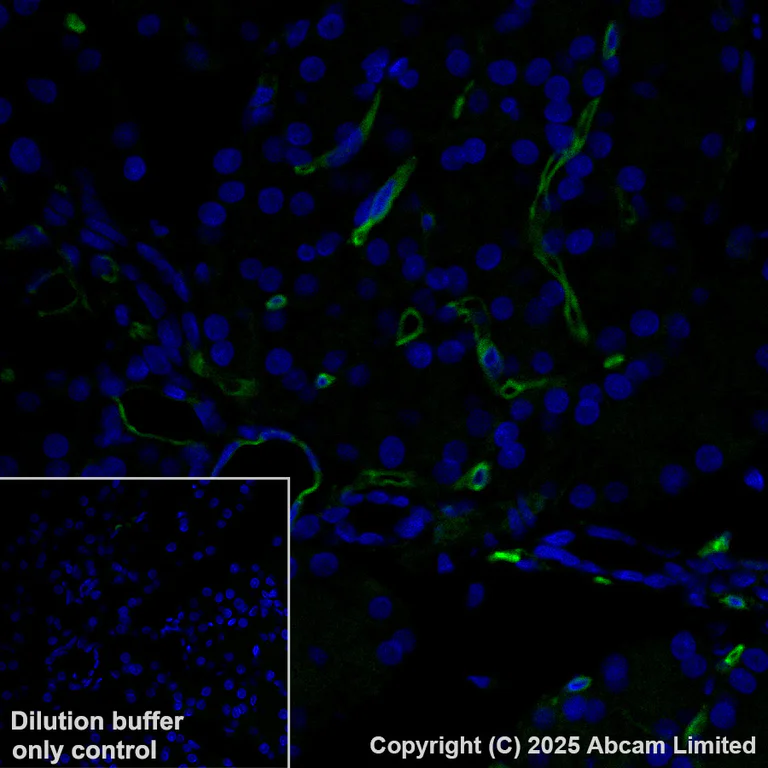 Immunohistochemistry (Formalin/PFA-fixed paraffin-embedded sections) - Alexa Fluor® 488 Anti-CD34 antibody [EPR27431-71] (AB323449)