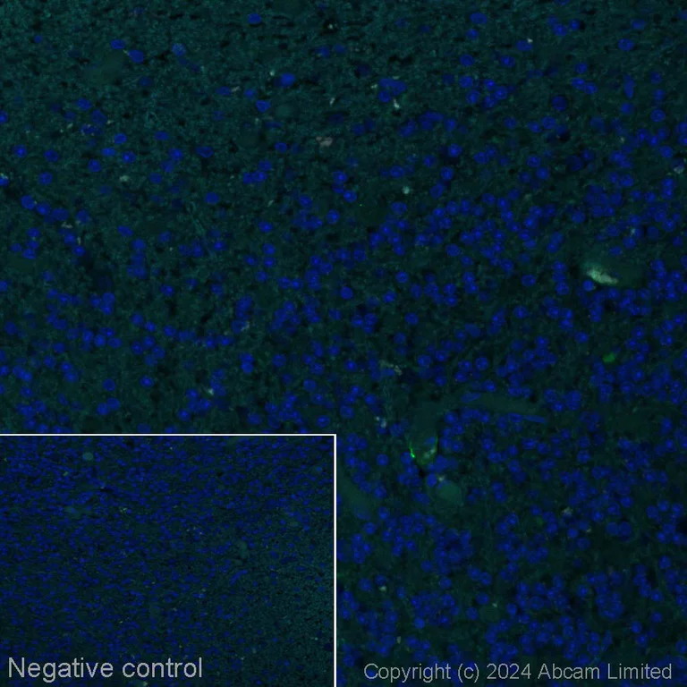 Immunohistochemistry (Formalin/PFA-fixed paraffin-embedded sections) - Alexa Fluor® 488 Anti-CD36 antibody [EPR22509-40] (AB320068)
