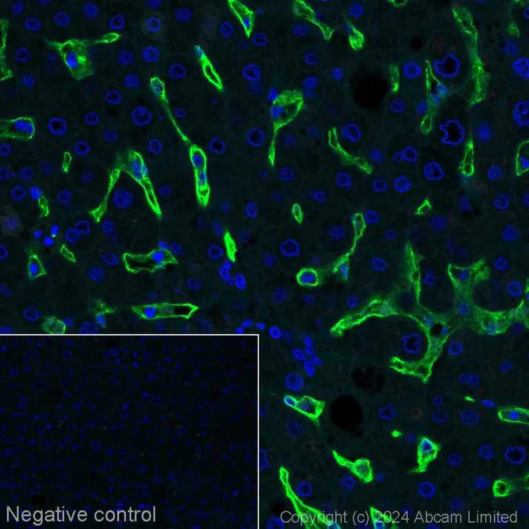 Immunohistochemistry (Formalin/PFA-fixed paraffin-embedded sections) - Alexa Fluor® 488 Anti-CD36 antibody [EPR22509-40] (AB320068)