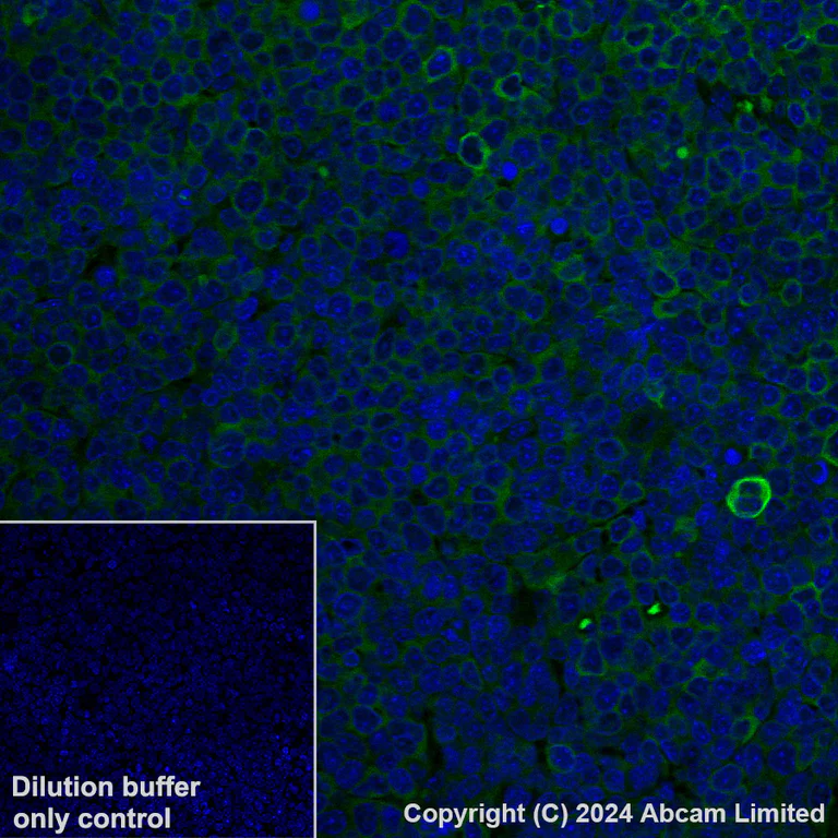 Immunohistochemistry (Formalin/PFA-fixed paraffin-embedded sections) - Alexa Fluor® 488 Anti-CD37 antibody [EPR28769-31] (AB321859)