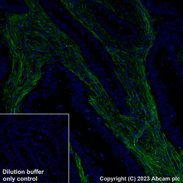 Immunohistochemistry (Formalin/PFA-fixed paraffin-embedded sections) - Alexa Fluor® 488 Anti-CD39 antibody [EPR20627] (AB313728)