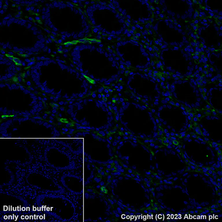 Immunohistochemistry (Formalin/PFA-fixed paraffin-embedded sections) - Alexa Fluor® 488 Anti-CD39 antibody [EPR20627] (AB313728)