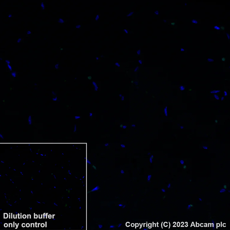Immunohistochemistry (Formalin/PFA-fixed paraffin-embedded sections) - Alexa Fluor® 488 Anti-CD39 antibody [EPR20627] (AB313728)