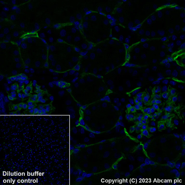 Immunohistochemistry (Formalin/PFA-fixed paraffin-embedded sections) - Alexa Fluor® 488 Anti-CD39 antibody [EPR20627] (AB313728)