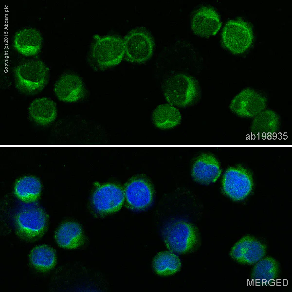 Immunocytochemistry/ Immunofluorescence - Alexa Fluor® 488 Anti-CD3D antibody [EP4426] (AB198935)