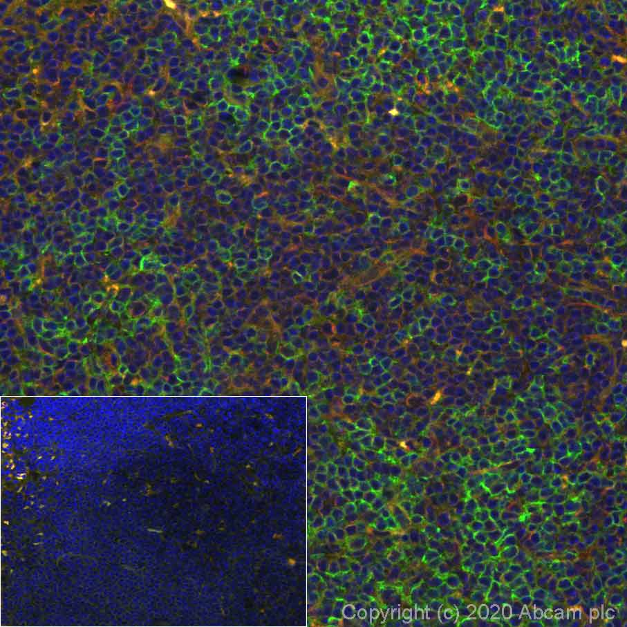 Immunohistochemistry (Formalin/PFA-fixed paraffin-embedded sections) - Alexa Fluor® 488 Anti-CD4 antibody [EPR19514] (AB277275), expandable thumbnail