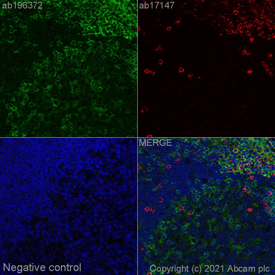 Immunohistochemistry (Formalin/PFA-fixed paraffin-embedded sections) - Alexa Fluor® 488 Anti-CD4 antibody [EPR6855] (AB196372), expandable thumbnail