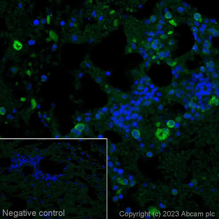 Immunohistochemistry (Formalin/PFA-fixed paraffin-embedded sections) - Alexa Fluor® 488 Anti-CD42b antibody [SP219] (AB314271)