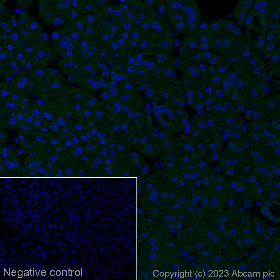 Immunohistochemistry (Formalin/PFA-fixed paraffin-embedded sections) - Alexa Fluor® 488 Anti-CD42b antibody [SP219] (AB314271), expandable thumbnail