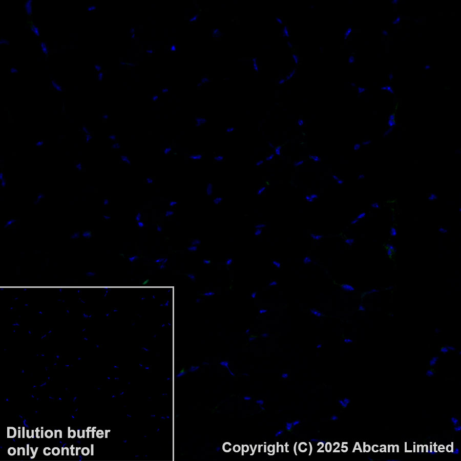 Immunohistochemistry (Formalin/PFA-fixed paraffin-embedded sections) - Alexa Fluor® 488 Anti-CD47 antibody [EPR28770-376] (AB323897), expandable thumbnail