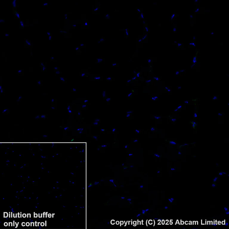 Immunohistochemistry (Formalin/PFA-fixed paraffin-embedded sections) - Alexa Fluor® 488 Anti-CD47 antibody [EPR28770-376] (AB323897)
