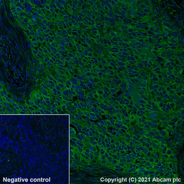 Immunohistochemistry (Formalin/PFA-fixed paraffin-embedded sections) - Alexa Fluor® 488 Anti-CD47 antibody [SP279] (AB290989), expandable thumbnail