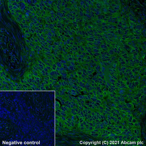 Immunohistochemistry (Formalin/PFA-fixed paraffin-embedded sections) - Alexa Fluor® 488 Anti-CD47 antibody [SP279] (AB290989)
