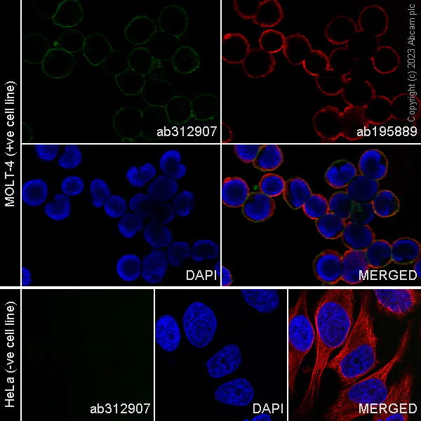 Immunocytochemistry/ Immunofluorescence - Alexa Fluor® 488 Anti-CD5 antibody [EPR26532-12] (AB312907)