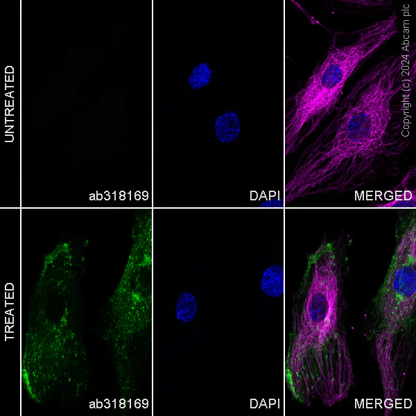 Immunocytochemistry/ Immunofluorescence - Alexa Fluor® 488 Anti-CD62E antibody [EPR25616-62] (AB318169)