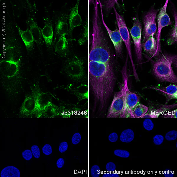 Immunocytochemistry/ Immunofluorescence - Alexa Fluor® 488 Anti-CD63 antibody [KILL150A] (AB318246)