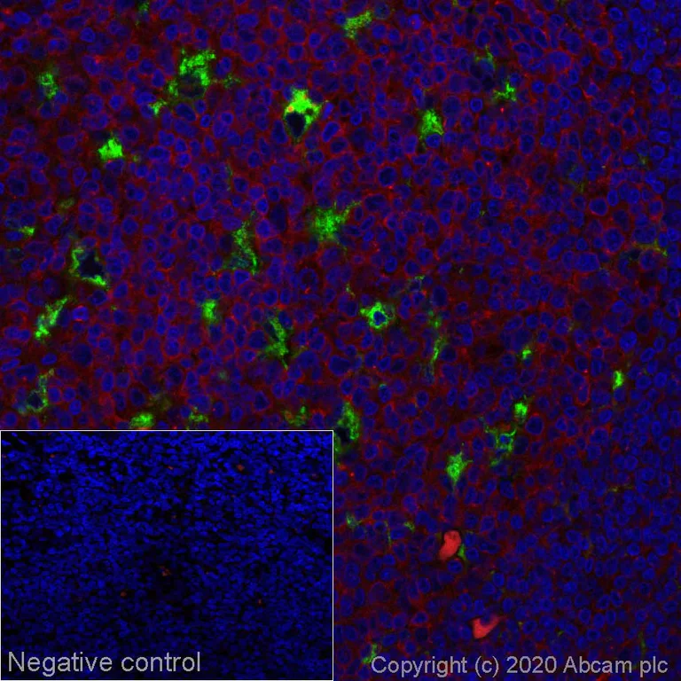 Immunohistochemistry (Formalin/PFA-fixed paraffin-embedded sections) - Alexa Fluor® 488 Anti-CD68 antibody [EPR20545] (AB277276)