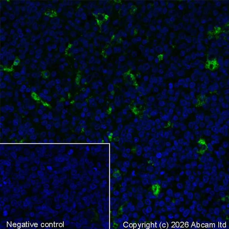 Immunohistochemistry (Formalin/PFA-fixed paraffin-embedded sections) - Alexa Fluor® 488 Anti-CD68 antibody [KP1] (AB222914)