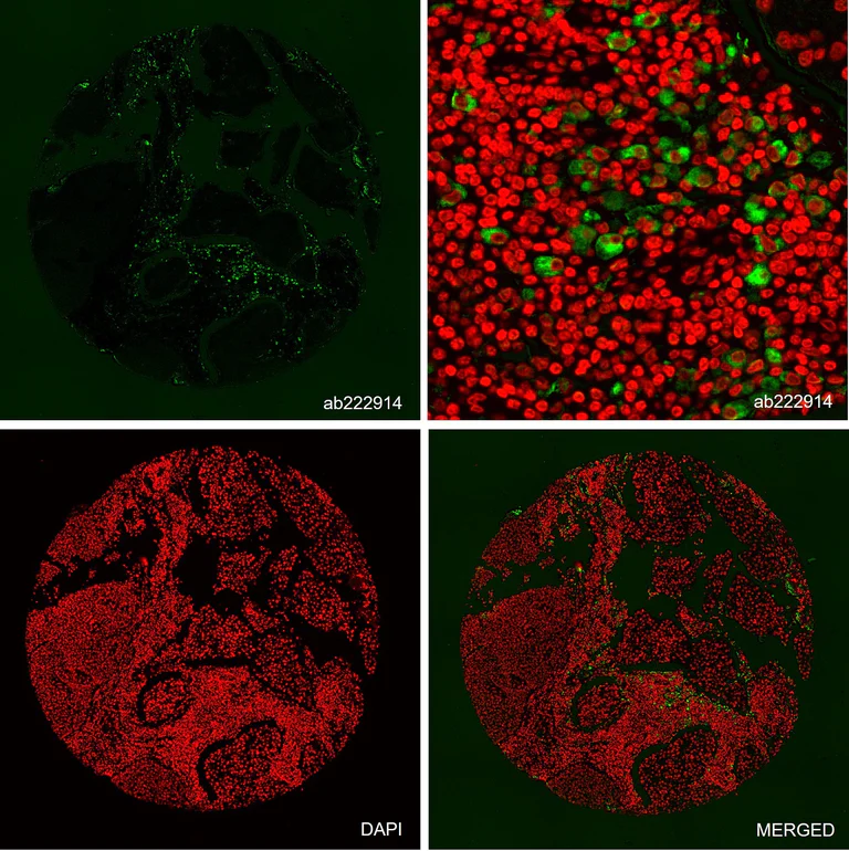 Alexa Fluor® 488 conjugated Anti-CD68 antibody [KP1] (ab222914