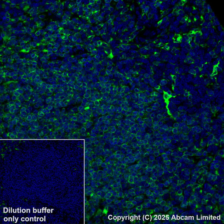 Immunohistochemistry (Formalin/PFA-fixed paraffin-embedded sections) - Alexa Fluor® 488 Anti-CD74 antibody [EPR25399-94] (AB324289)