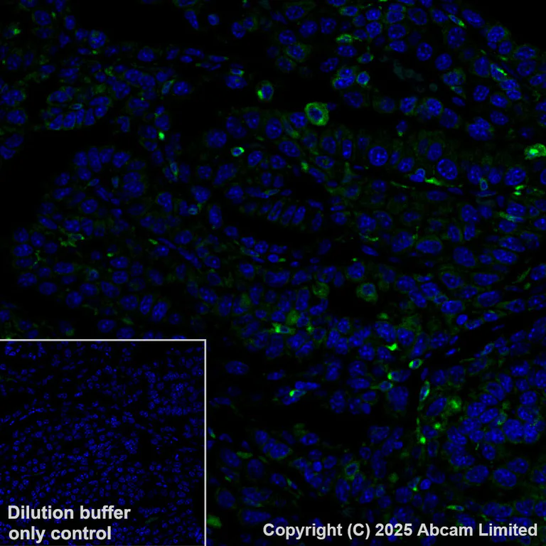 Immunohistochemistry (Formalin/PFA-fixed paraffin-embedded sections) - Alexa Fluor® 488 Anti-CD74 antibody [EPR25399-94] (AB324289)