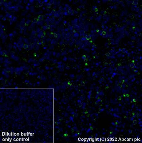 Immunohistochemistry (Formalin/PFA-fixed paraffin-embedded sections) - Alexa Fluor® 488 Anti-CD79a antibody [EPR26537-114] (AB307774), expandable thumbnail