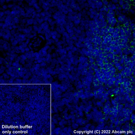 Immunohistochemistry (Formalin/PFA-fixed paraffin-embedded sections) - Alexa Fluor® 488 Anti-CD79a antibody [EPR26537-114] (AB307774), expandable thumbnail