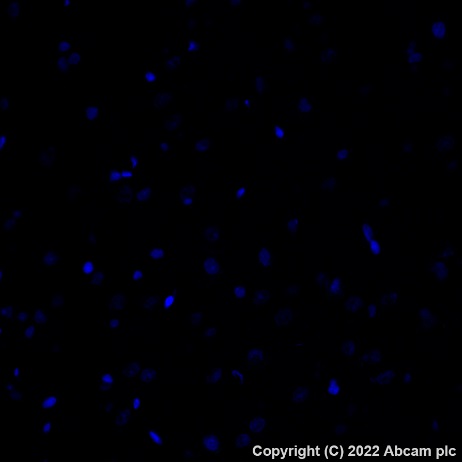 Immunohistochemistry (Formalin/PFA-fixed paraffin-embedded sections) - Alexa Fluor® 488 Anti-CD79a antibody [EPR26537-114] (AB307774), expandable thumbnail