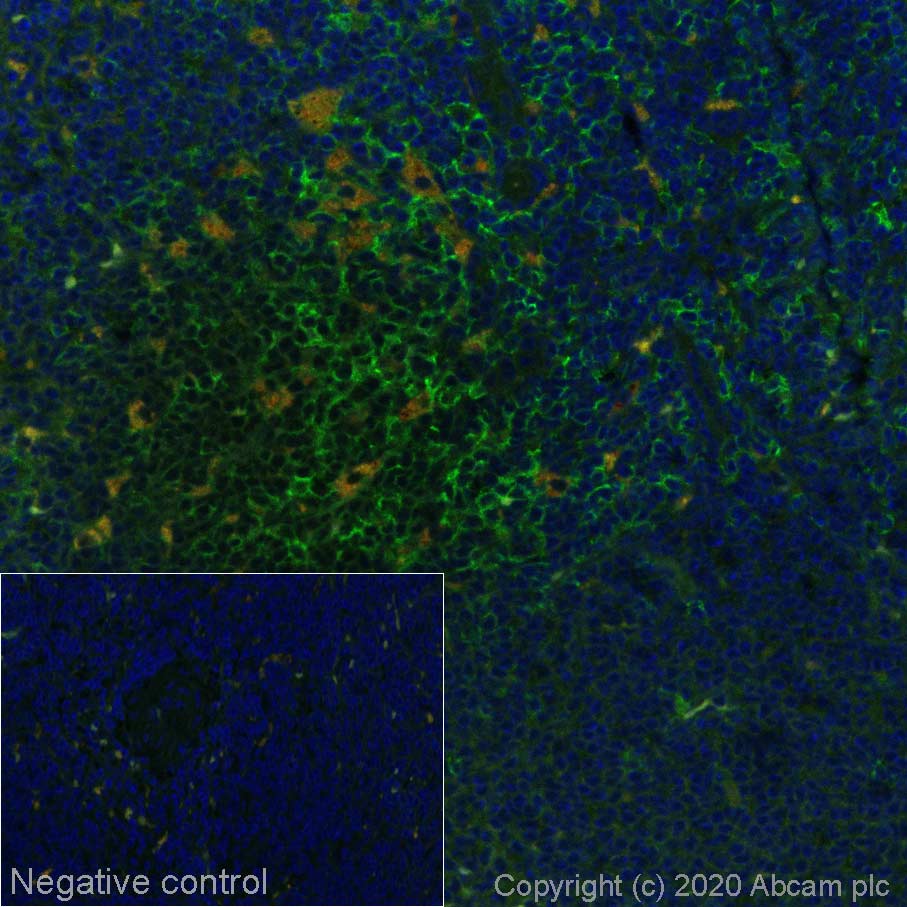 Immunohistochemistry (Formalin/PFA-fixed paraffin-embedded sections) - Alexa Fluor® 488 Anti-CD8 alpha antibody [CAL38] (AB270926), expandable thumbnail