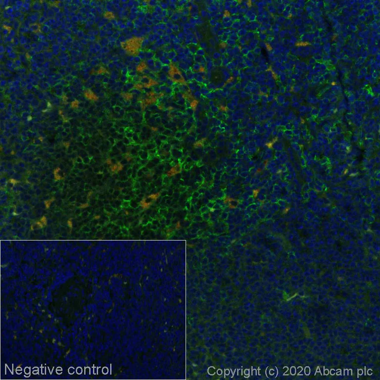 Immunohistochemistry (Formalin/PFA-fixed paraffin-embedded sections) - Alexa Fluor® 488 Anti-CD8 alpha antibody [CAL38] (AB270926)
