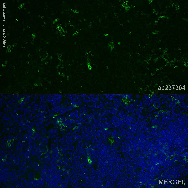 Immunohistochemistry (Formalin/PFA-fixed paraffin-embedded sections) - Alexa Fluor® 488 Anti-CD8 alpha antibody [EPR21769] (AB237364)