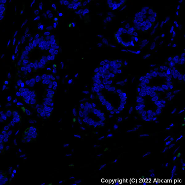 Immunohistochemistry (Formalin/PFA-fixed paraffin-embedded sections) - Alexa Fluor® 488 Anti-CD8 alpha antibody [SP239] (AB300091)