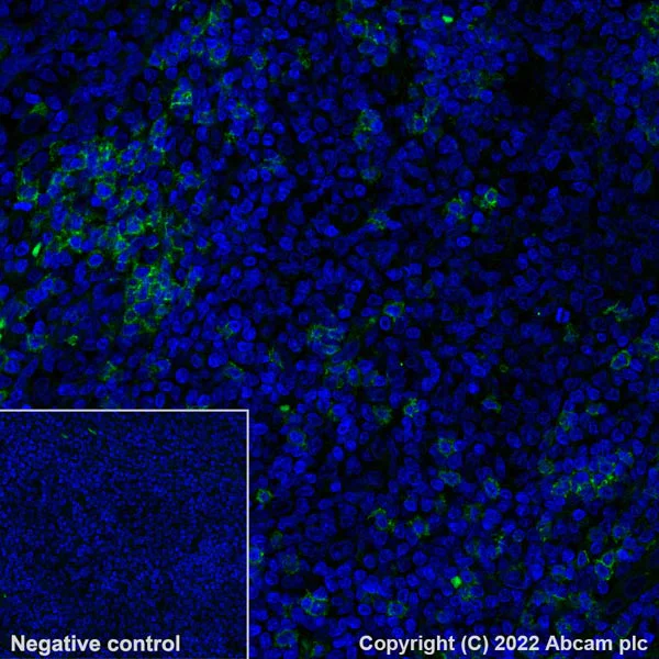 Immunohistochemistry (Formalin/PFA-fixed paraffin-embedded sections) - Alexa Fluor® 488 Anti-CD8 alpha antibody [SP239] (AB300091)