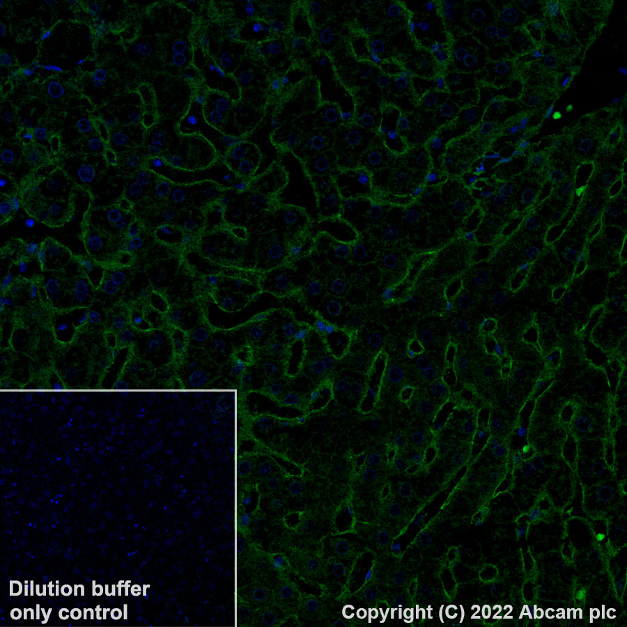 Immunohistochemistry (Formalin/PFA-fixed paraffin-embedded sections) - Alexa Fluor® 488 Anti-CD81 antibody [EPR21916] (AB302976)