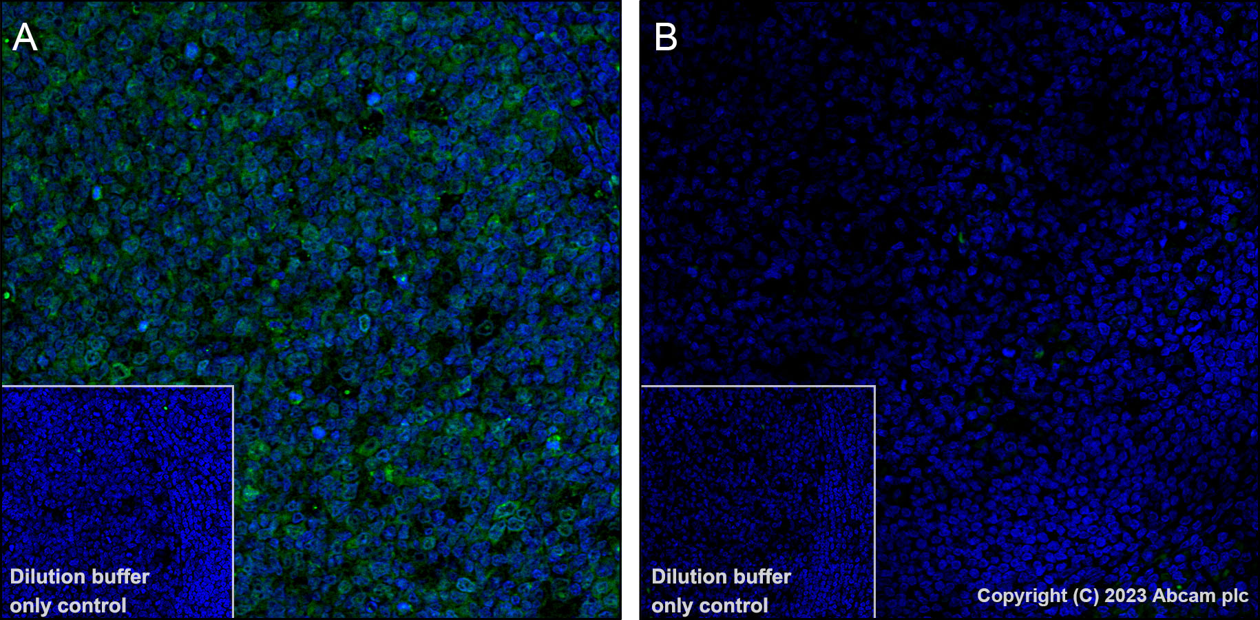 Immunohistochemistry (Formalin/PFA-fixed paraffin-embedded sections) - Alexa Fluor® 488 Anti-CDK1 + Cdk2 + Cdk3 (phospho T14) antibody [E161] (AB314672), expandable thumbnail