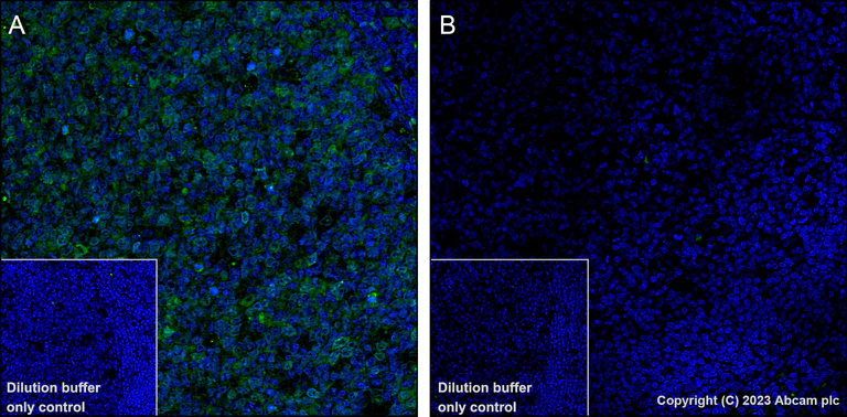 Immunohistochemistry (Formalin/PFA-fixed paraffin-embedded sections) - Alexa Fluor® 488 Anti-CDK1 + Cdk2 + Cdk3 (phospho T14) antibody [E161] (AB314672)