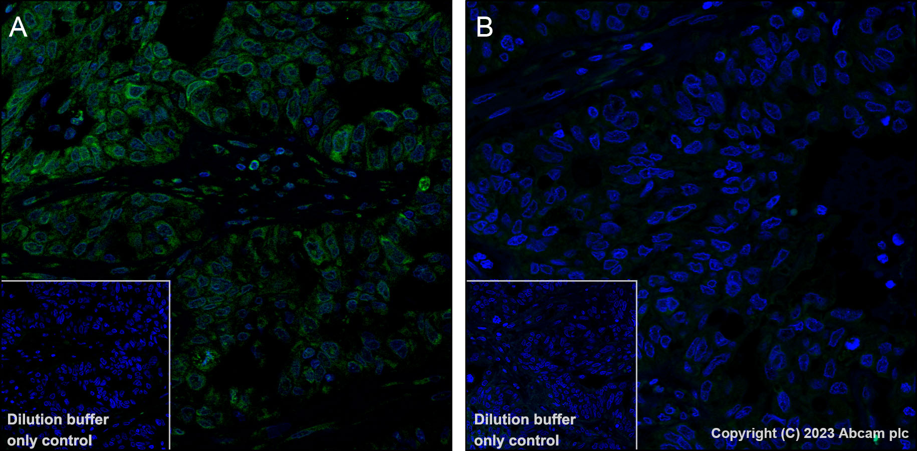 Immunohistochemistry (Formalin/PFA-fixed paraffin-embedded sections) - Alexa Fluor® 488 Anti-CDK1 + Cdk2 + Cdk3 (phospho T14) antibody [E161] (AB314672), expandable thumbnail
