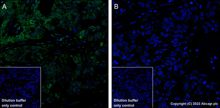 Immunohistochemistry (Formalin/PFA-fixed paraffin-embedded sections) - Alexa Fluor® 488 Anti-CDK1 + Cdk2 + Cdk3 (phospho T14) antibody [E161] (AB314672)