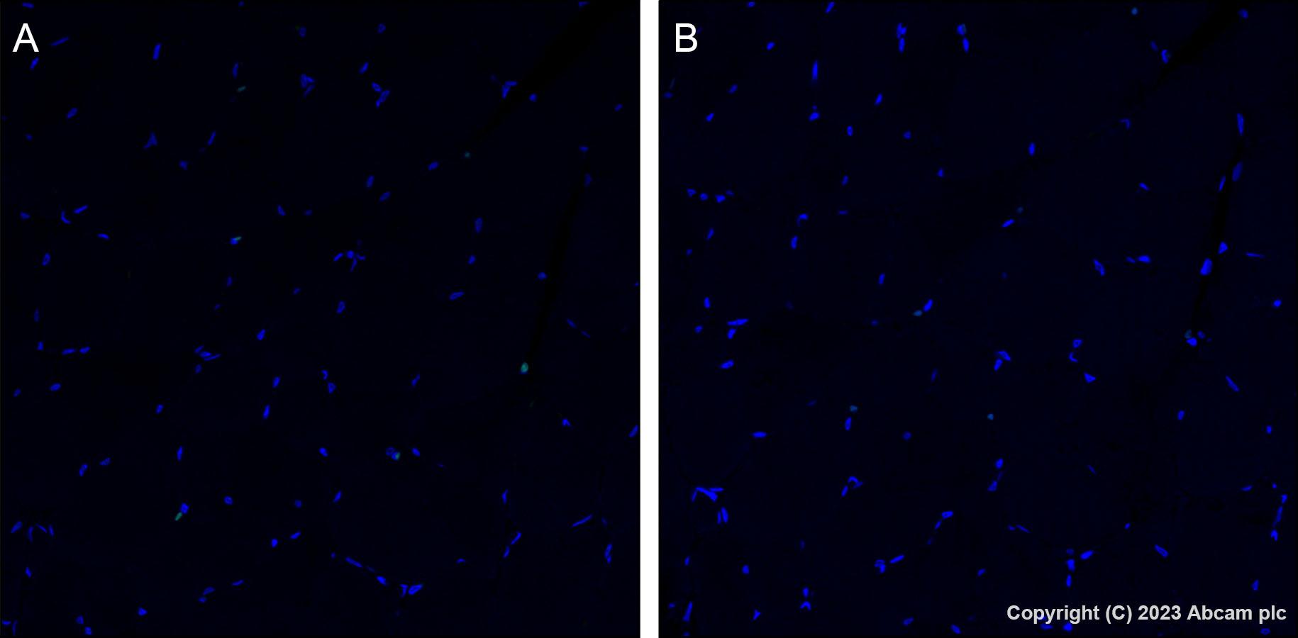 Immunohistochemistry (Formalin/PFA-fixed paraffin-embedded sections) - Alexa Fluor® 488 Anti-CDK1 + Cdk2 + Cdk3 (phospho T14) antibody [E161] (AB314672), expandable thumbnail