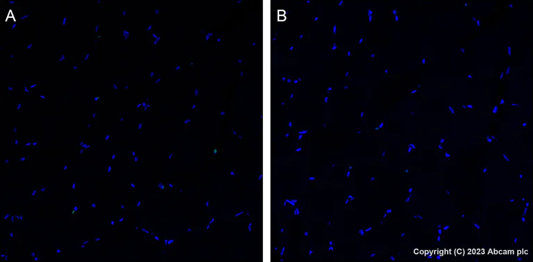 Immunohistochemistry (Formalin/PFA-fixed paraffin-embedded sections) - Alexa Fluor® 488 Anti-CDK1 + Cdk2 + Cdk3 (phospho T14) antibody [E161] (AB314672)