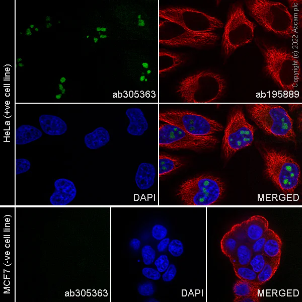 Immunocytochemistry/ Immunofluorescence - Alexa Fluor® 488 Anti-CDKN2A/p14ARF antibody [SP271] (AB305363)