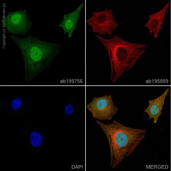 Immunocytochemistry/ Immunofluorescence - Alexa Fluor® 488 Anti-CDKN2A/p16INK4A + CDKN2B/p15INK4B antibody [EP435Y-129R] (AB199756)