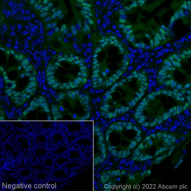 Immunohistochemistry (Formalin/PFA-fixed paraffin-embedded sections) - Alexa Fluor® 488 Anti-CDX2 antibody [EPR2764Y] (AB195007), expandable thumbnail