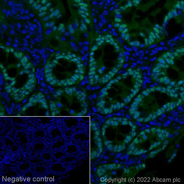 Immunohistochemistry (Formalin/PFA-fixed paraffin-embedded sections) - Alexa Fluor® 488 Anti-CDX2 antibody [EPR2764Y] (AB195007)