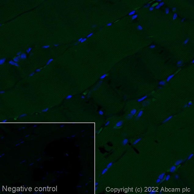 Immunohistochemistry (Formalin/PFA-fixed paraffin-embedded sections) - Alexa Fluor® 488 Anti-CDX2 antibody [EPR2764Y] (AB195007), expandable thumbnail