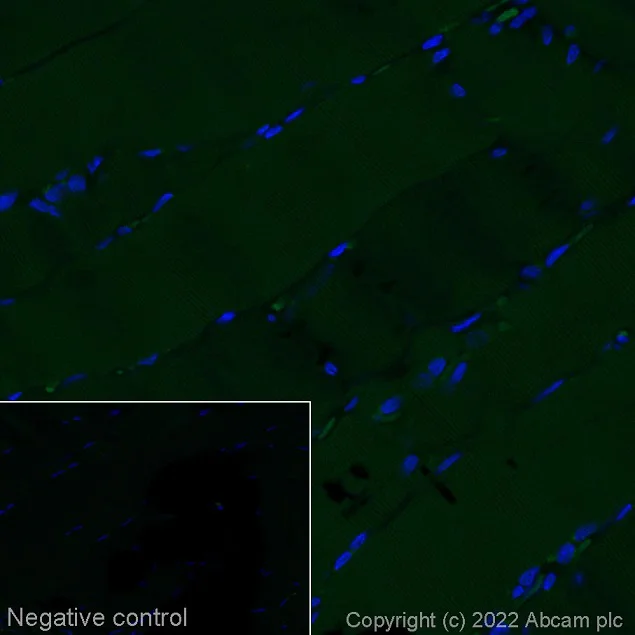 Immunohistochemistry (Formalin/PFA-fixed paraffin-embedded sections) - Alexa Fluor® 488 Anti-CDX2 antibody [EPR2764Y] (AB195007)