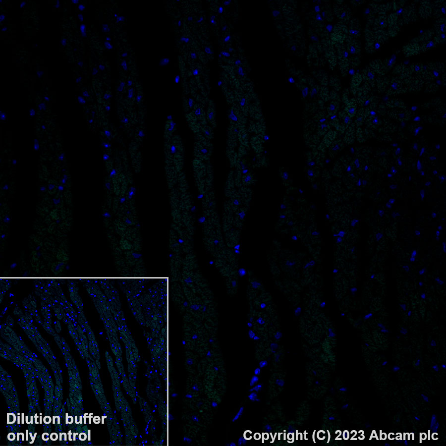 Immunohistochemistry (Formalin/PFA-fixed paraffin-embedded sections) - Alexa Fluor® 488 Anti-CDX2 antibody [EPR2764Y] (AB195007), expandable thumbnail